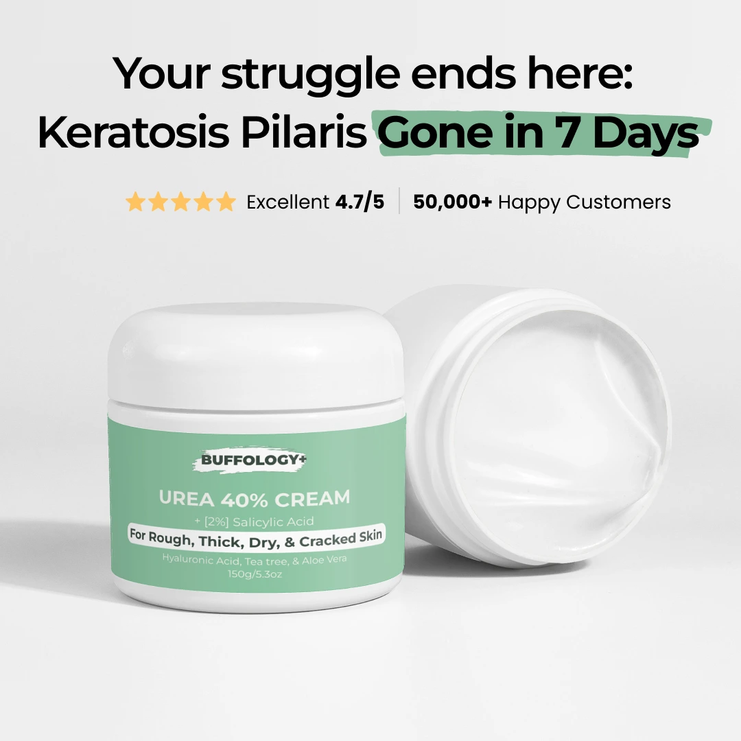 Urea Cream 40% for Keratosis Pilaris