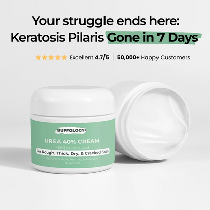 Urea Cream 40% for Keratosis Pilaris