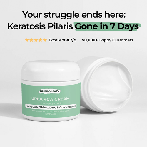 Urea Cream 40% for Keratosis Pilaris